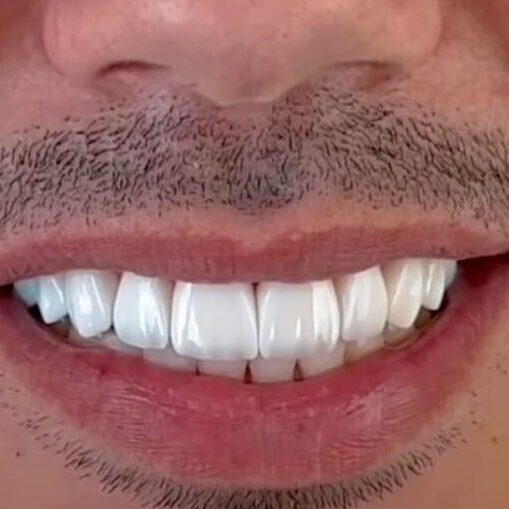 IMG-20250304-WA0009-edited-1